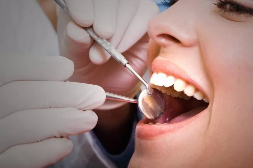 Deep Dental Cleaning
